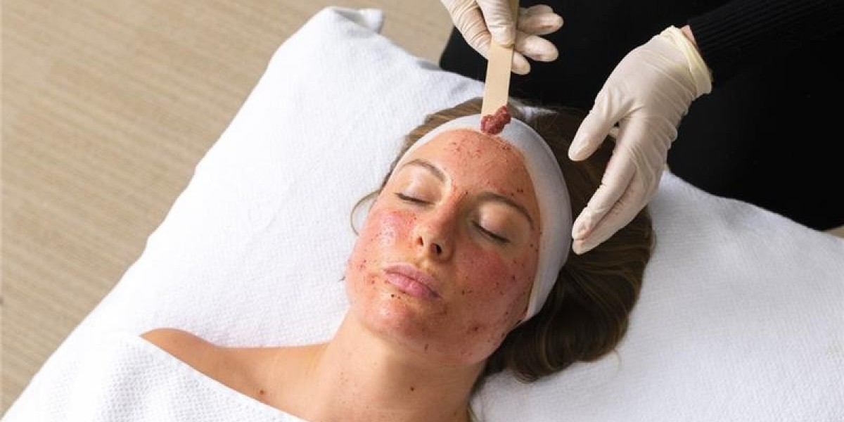 How Do Chemical Peels Clean and Nourish Skin?
