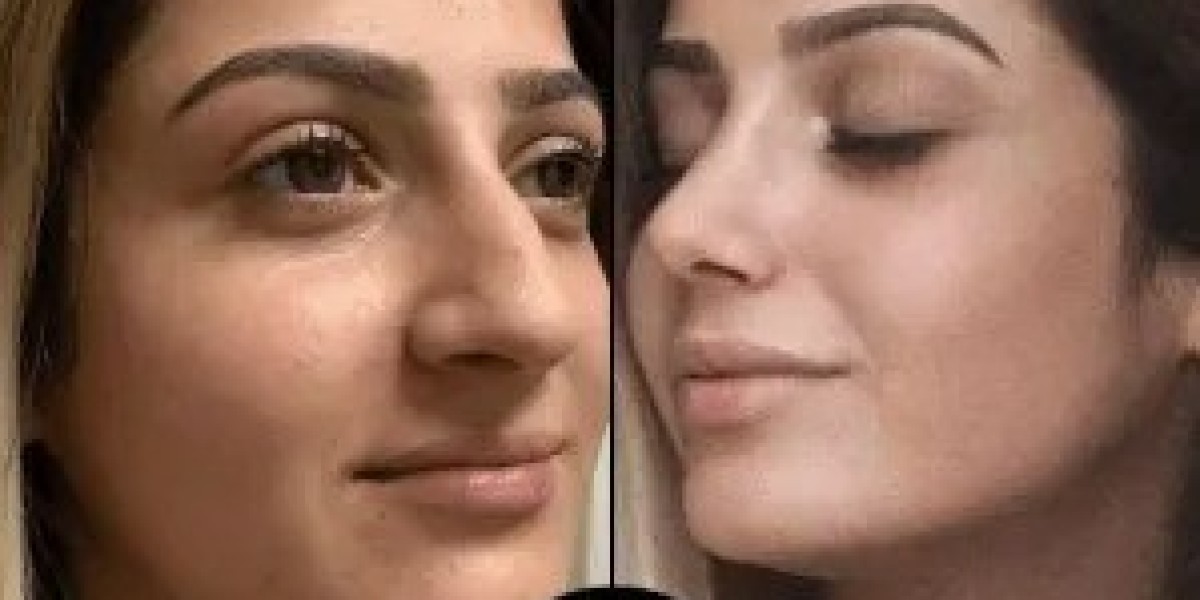 Best Aesthetic Clinics in Dubai for Men and Women