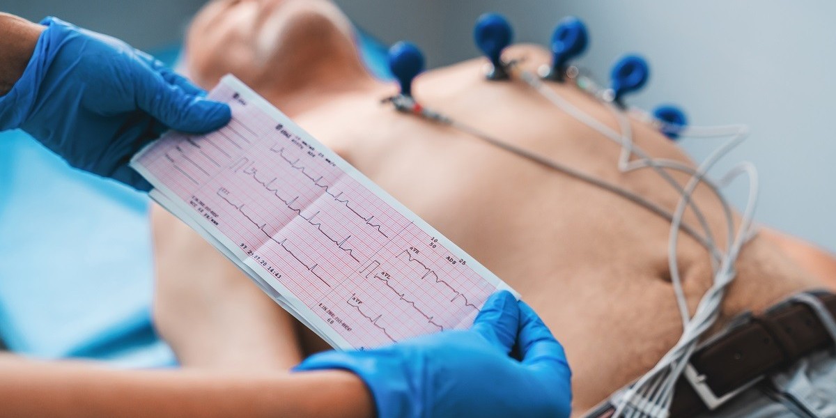 Best Echocardiography Testing Centres in Bangalore: Your Comprehensive 2025 Guide