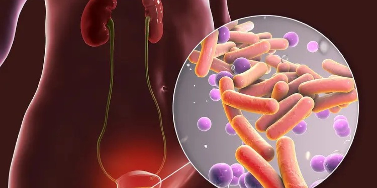 Urinary Tract Infection (UTI): Causes, Symptoms & Treatment