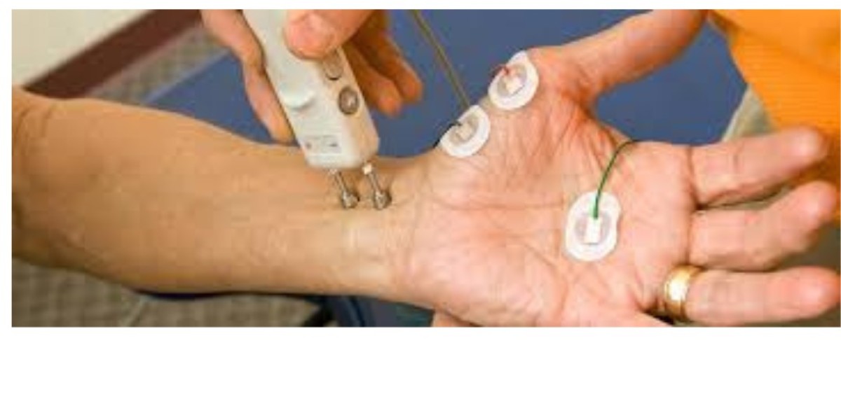 NCV Test Near Me: Everything You Need to Know About Nerve Conduction Studies