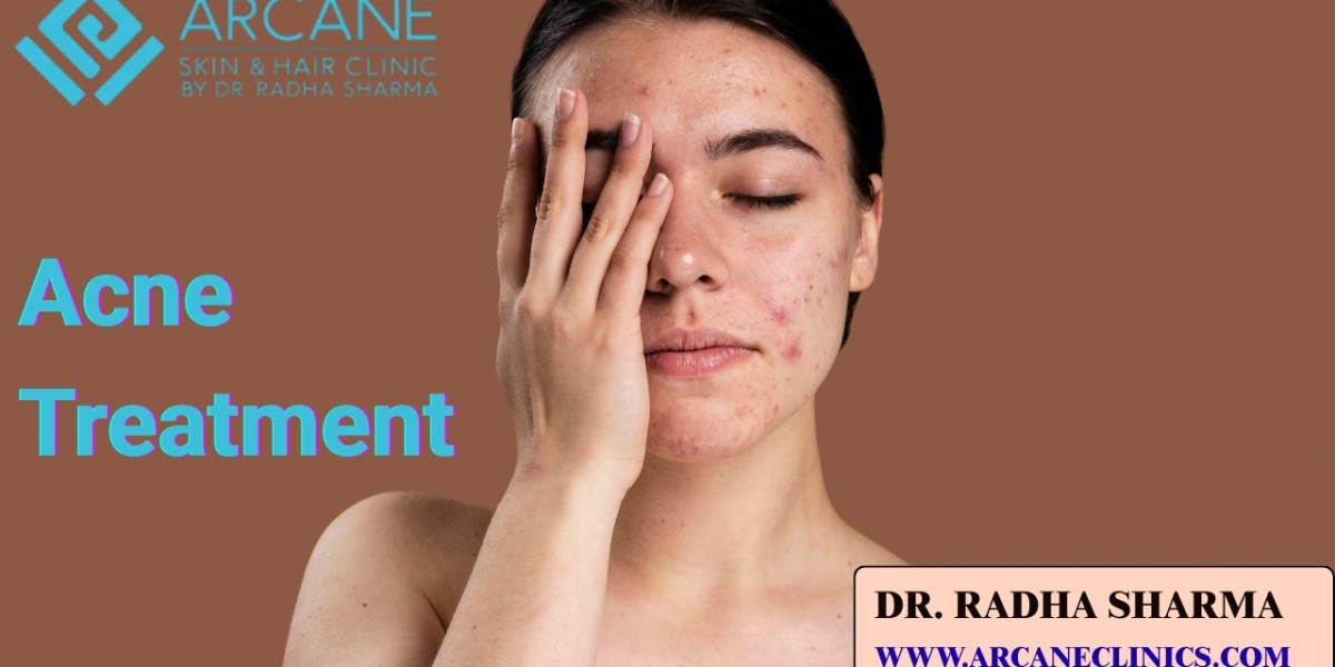 Types, Causes and Treatments for Acne