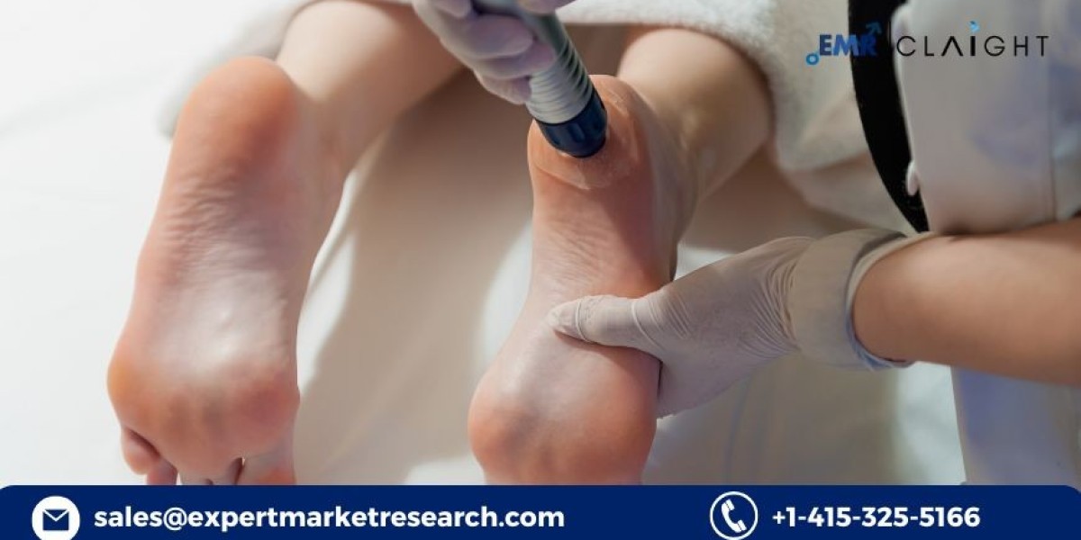 Shock Wave Therapy Device Market: Future Growth and Future Outlook (2034)