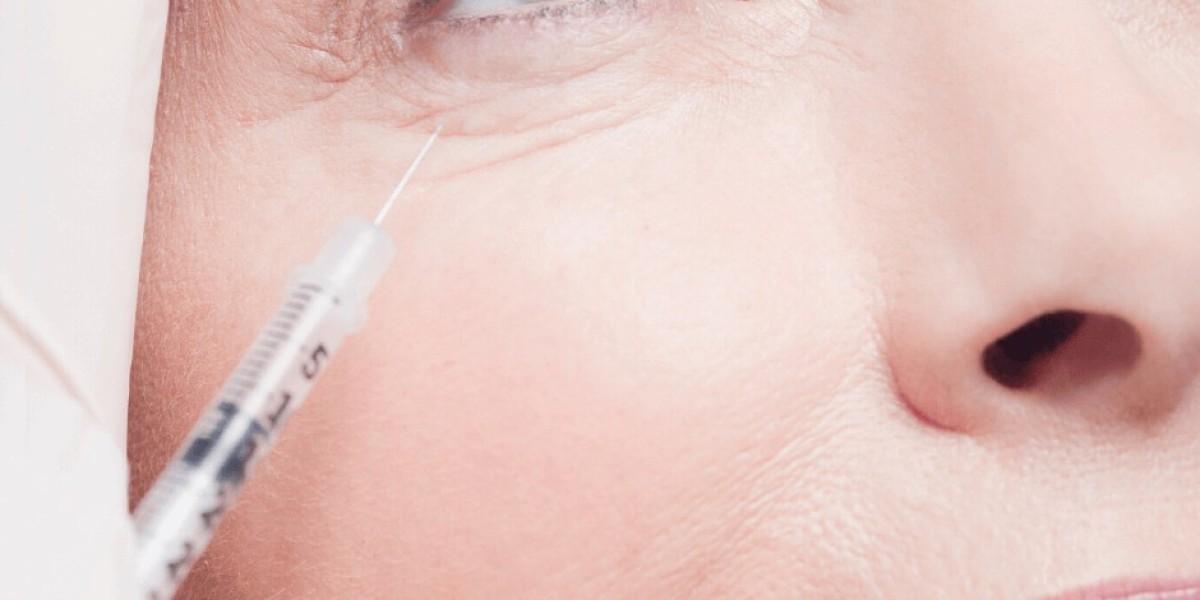 Under Eye Fillers in Dubai: Non-Surgical Fix for Eye Bags and Hollows