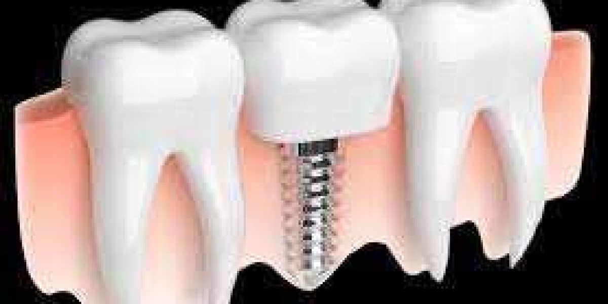 Dental Reestablishes Partake In Different Benefits